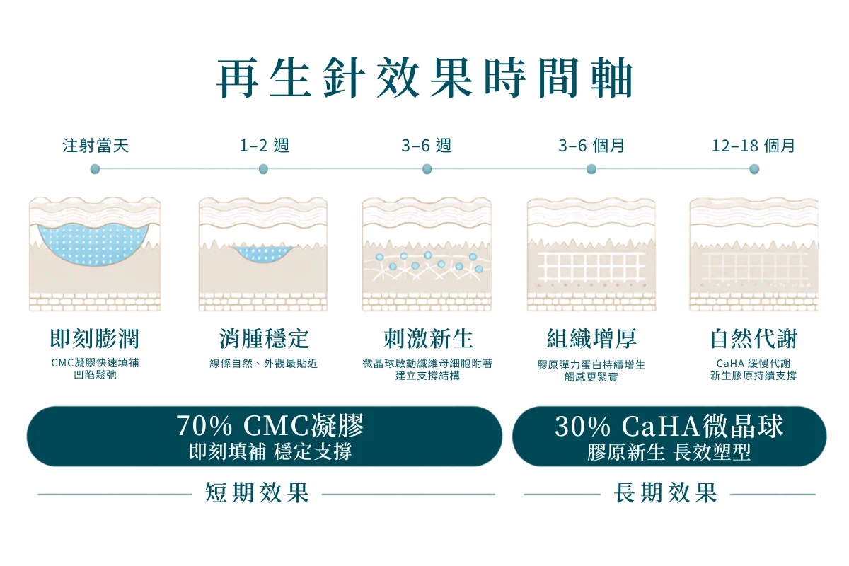 再生針效果如何?可以維持多久?
